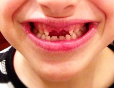 Zahnfee, Über Kinderglaube und Elternpein